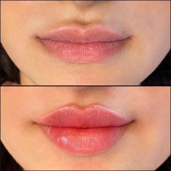 Russian lip filter